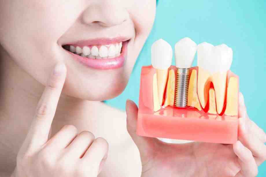 How long does pain and swelling last after dental implant?