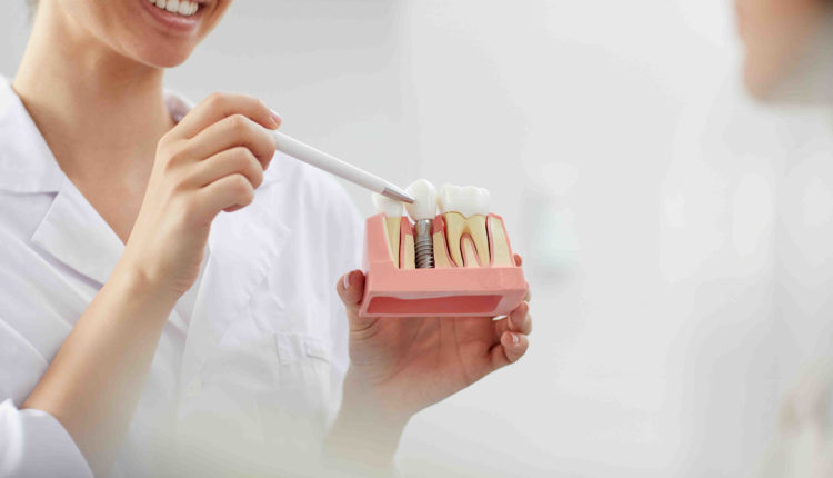 How long should i wait to get dental implants after extraction