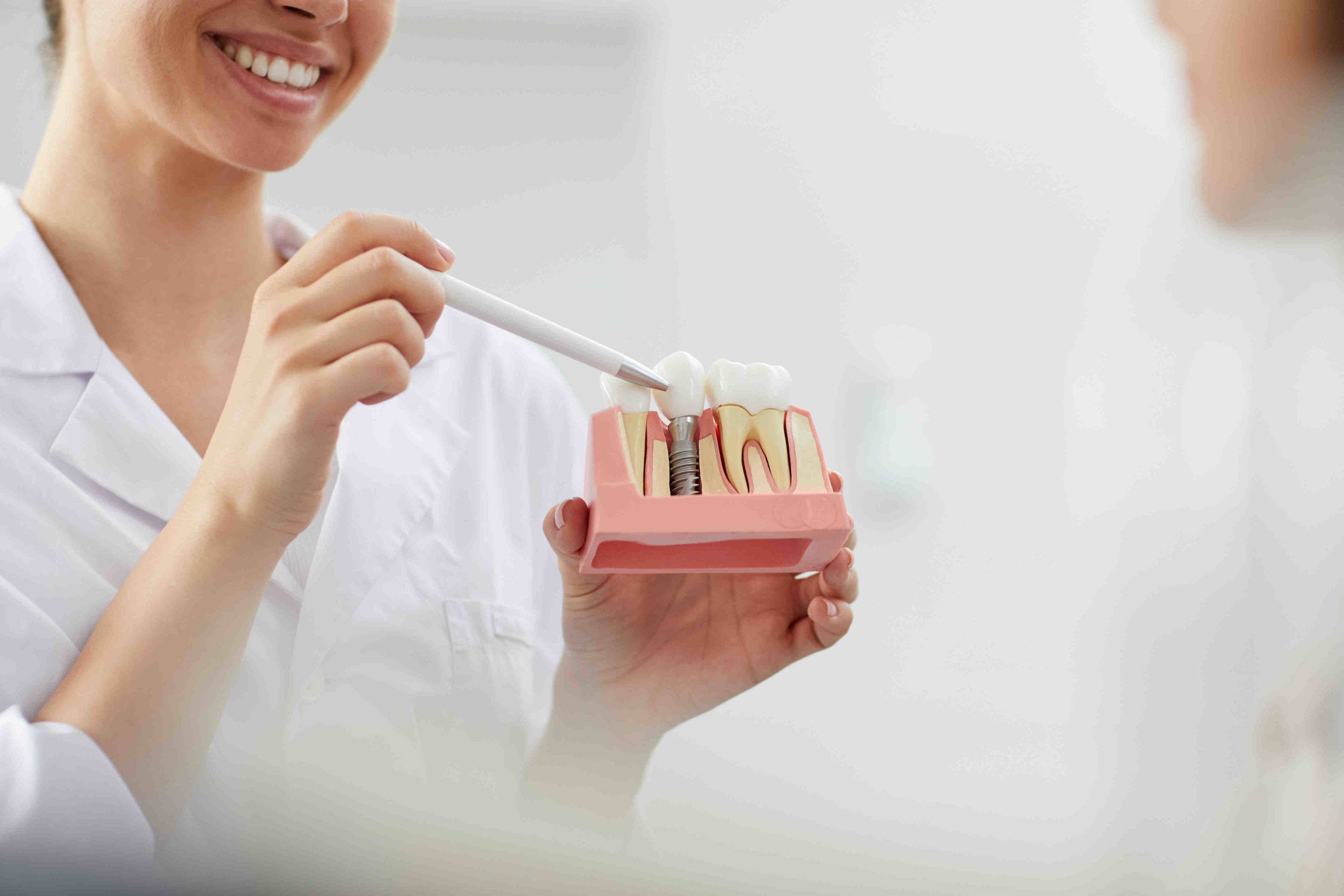 How Long Should I Wait To Get Dental Implants After Extraction Dental 