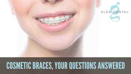 How much did braces cost in 1980?