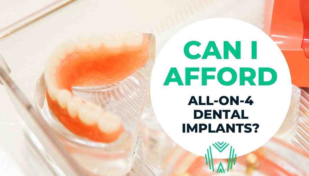 How much is a full top set of dental implants?