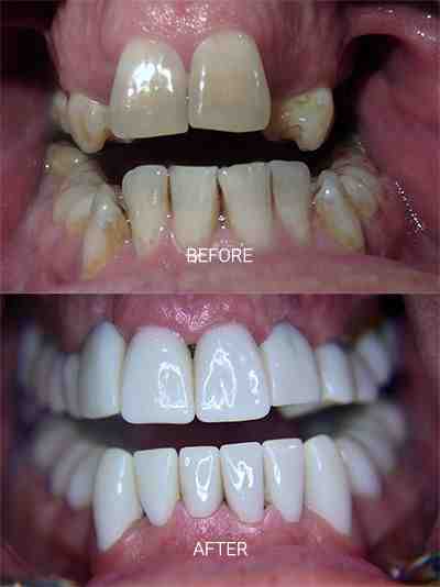 Is dentistry more difficult than medicine?