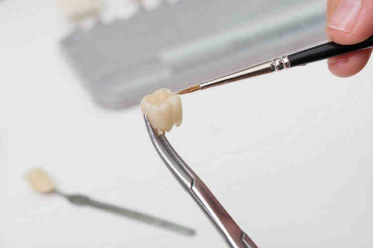 What happens if you dont get a crown? Dental News Network