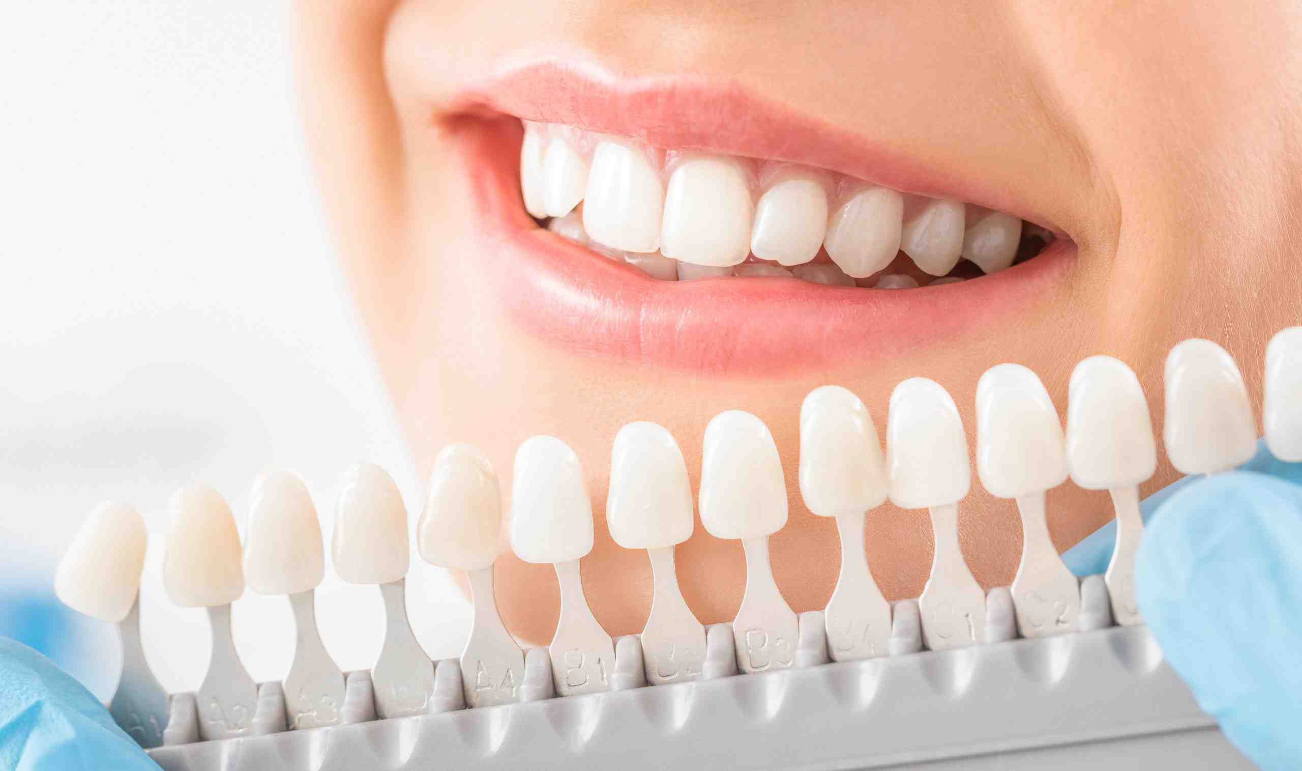 Is getting teeth whitened by dentist worth it?
