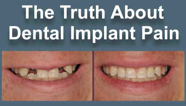 Is having dental implants painful