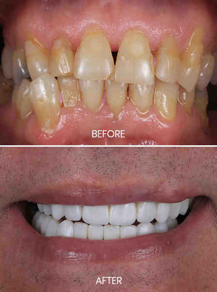 Is it hard to become a dentist in Mexico?