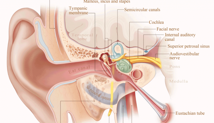 Is mastoiditis occur aftere dental implants