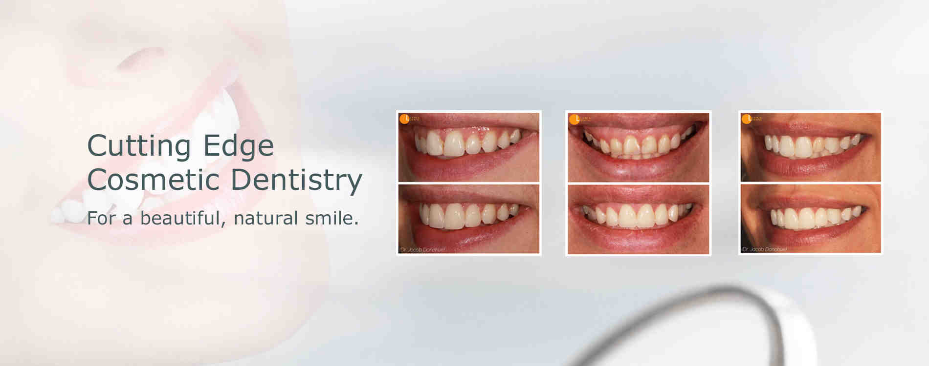 Is tooth reshaping painful?