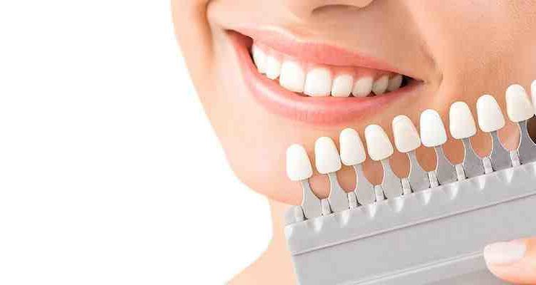 Tooth dental cosmetic dentistry insurance