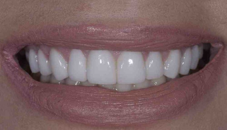 Top 10 cosmetic dentistry in souther california