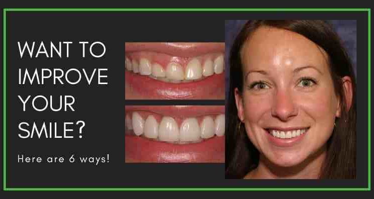 Top 5 cosmetic dentistry procedures that will improve your overall health