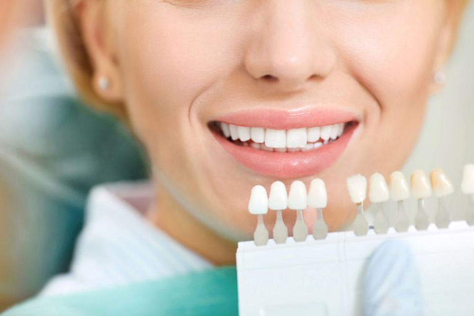 What are disadvantages of veneers?
