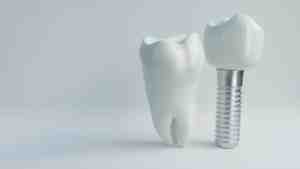What are the most common problems with dental implants?