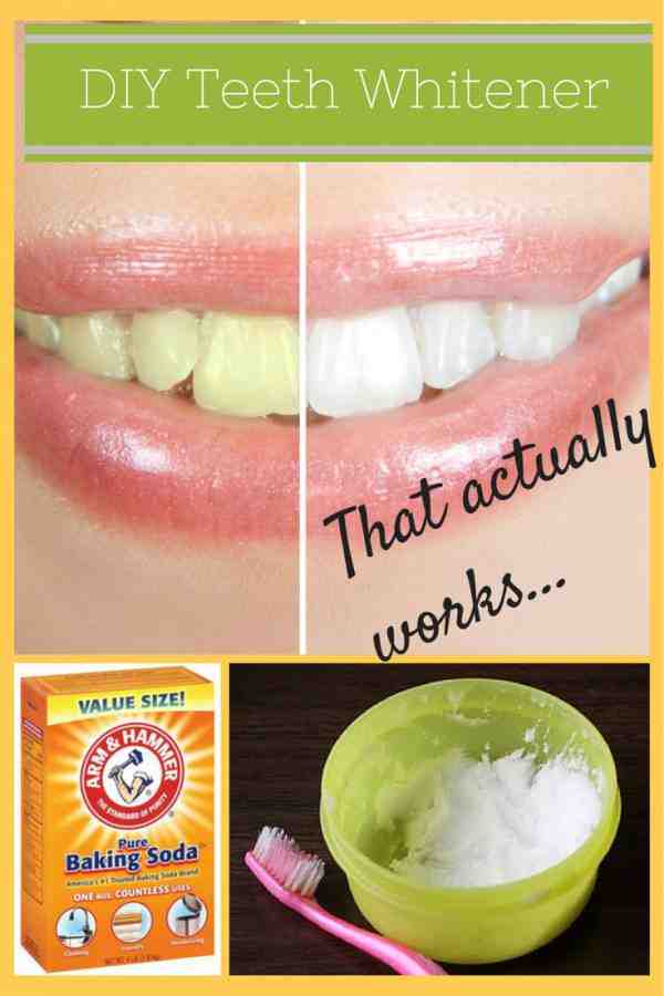 What causes yellow teeth in a teenager?