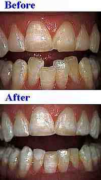 What does cosmetic mean in dentistry?