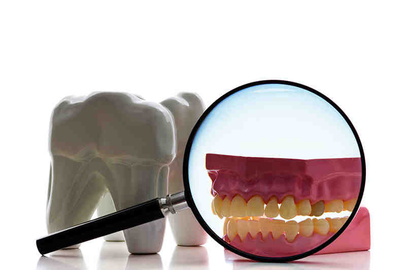 What happens if you don't get a root canal?