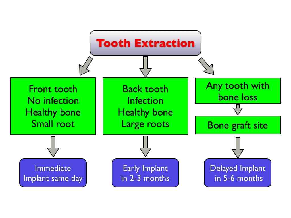 What hurts more tooth extraction or implant?