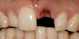What is a periodontist vs dentist?