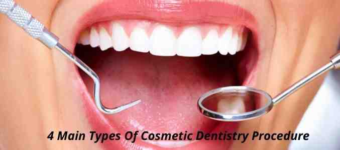 What is a smile Makeover?