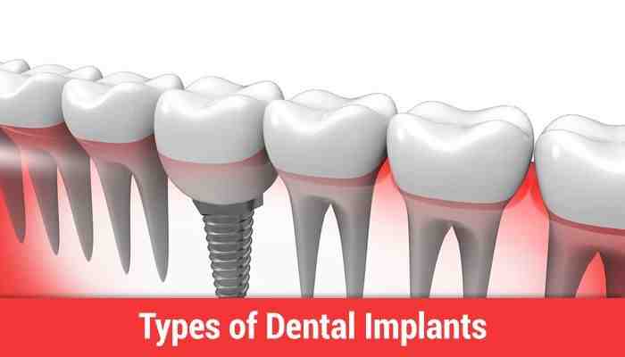 What is one of the disadvantages of ceramic dental implants?
