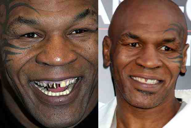 What percentage of 70 year olds have dentures?