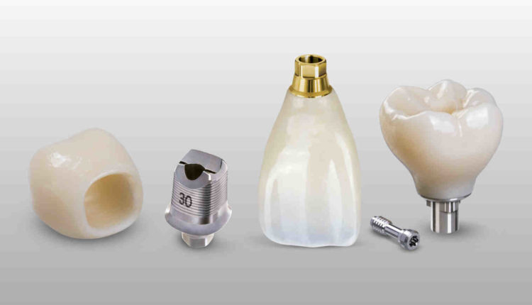 Where to buy dental implant cement