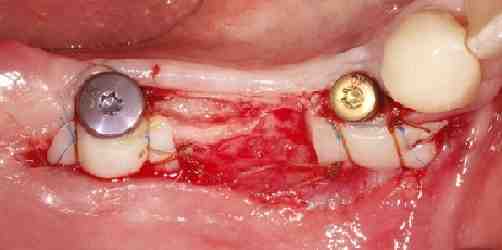 Which province has the lowest dental fees?