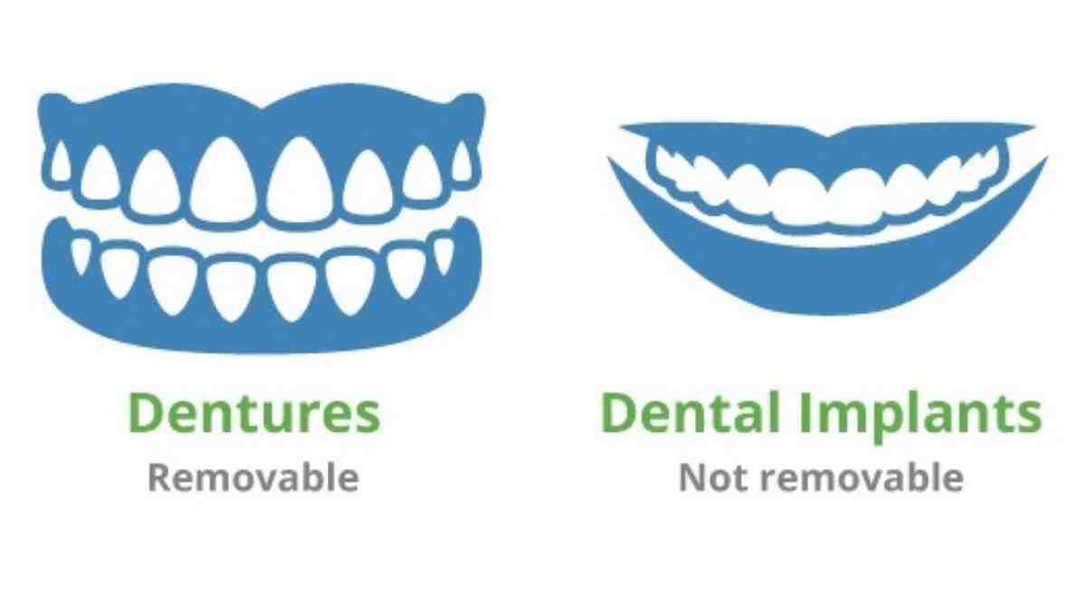 Who should not get an implant?