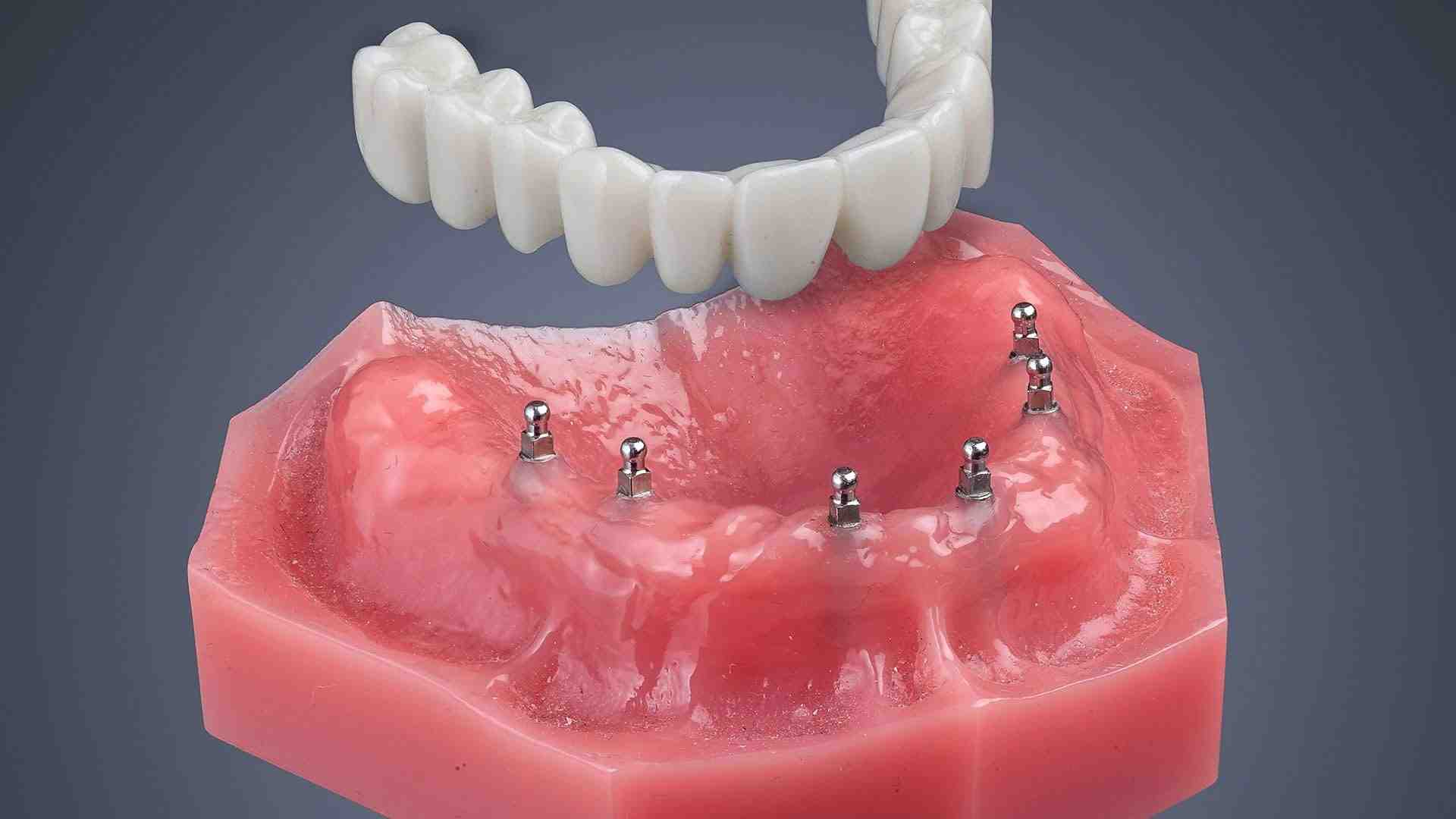 Why are my teeth rotting so fast?