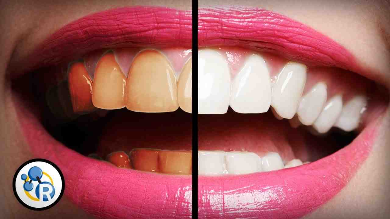 Why are my teeth still yellow after brushing everyday?