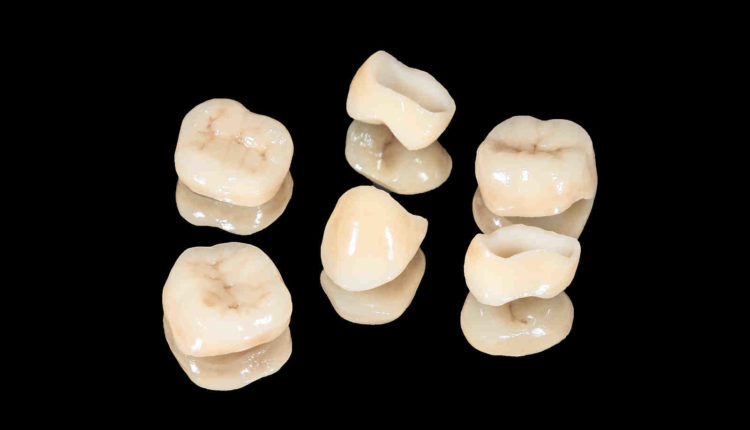 Why do dental crowns cost so much?