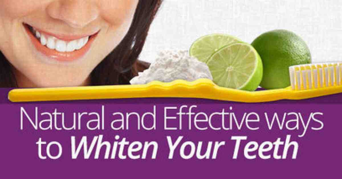 Why will my teeth not whiten?