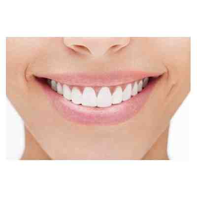 Will baking soda whiten teeth?